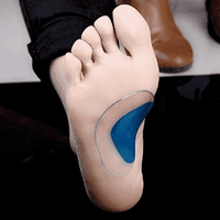 Thumbnail for Flat Foot Corrector Insoles PeekWise