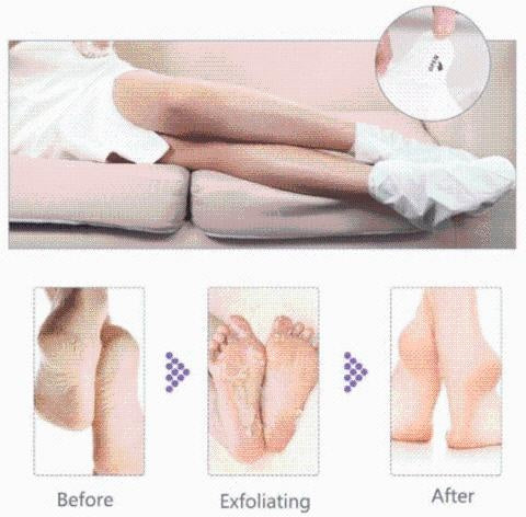 Exfoliating Foot-Peel Refreshing Mask Set PeekWise