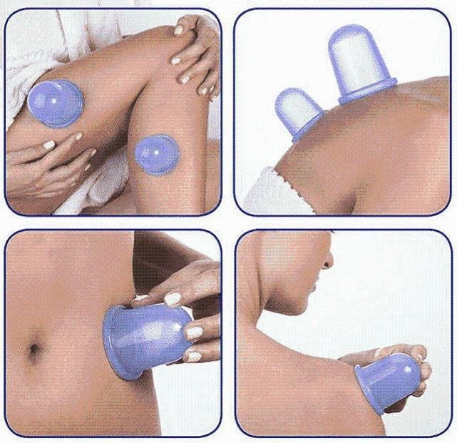 Anti Cellulite Vacuum Silicone Cups - PeekWise