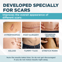 Thumbnail for ClearScar™ Advanced Scar Reduction Gel