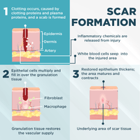 Thumbnail for ClearScar™ Advanced Scar Reduction Gel