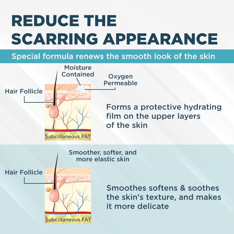 ClearScar™ Advanced Scar Reduction Gel