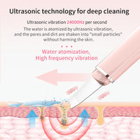 Thumbnail for ALN™ - Ultrasonic Skin Scrubber and Tightener