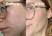 Thumbnail for product-image