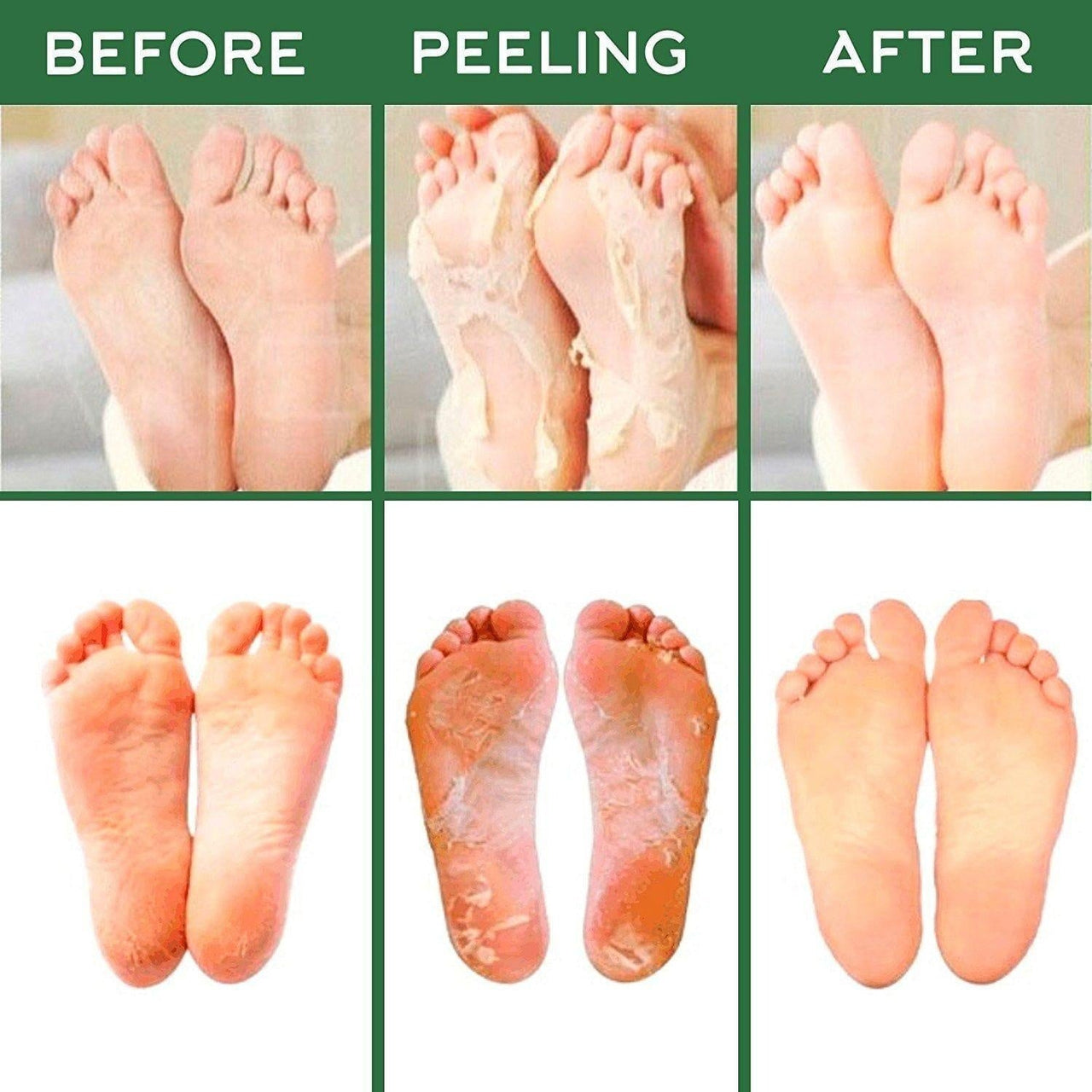 Exfoliating Foot-Peel Refreshing Mask Set PeekWise