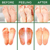 Thumbnail for Exfoliating Foot-Peel Refreshing Mask Set PeekWise