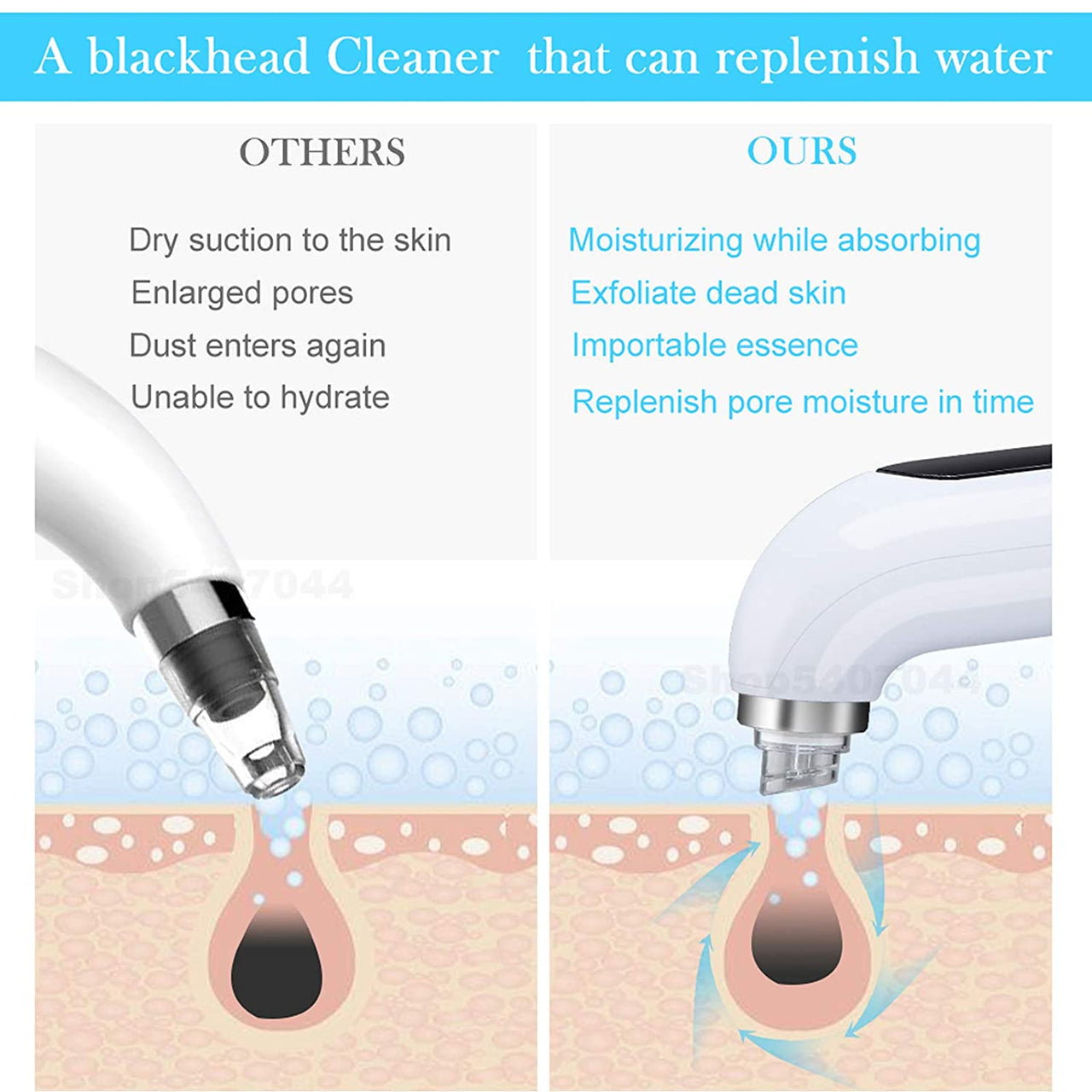 Blackhead Removal Tool PeekWise