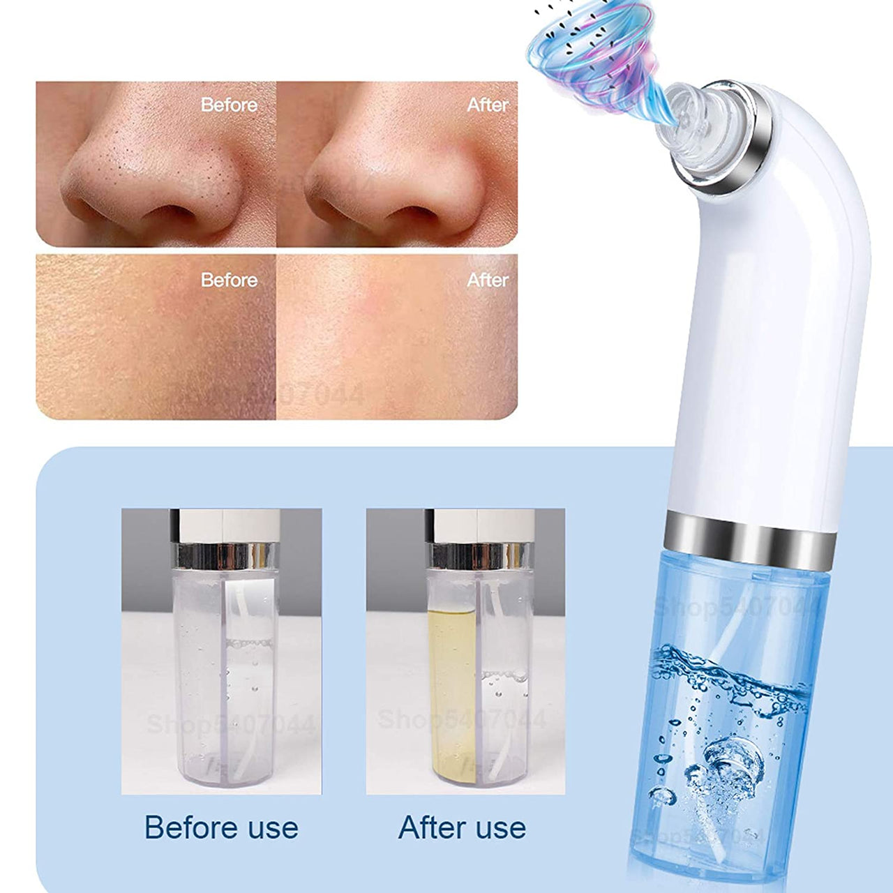 Blackhead Removal Tool PeekWise