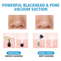 Thumbnail for Blackhead Remover Vacuum PRO PeekWise