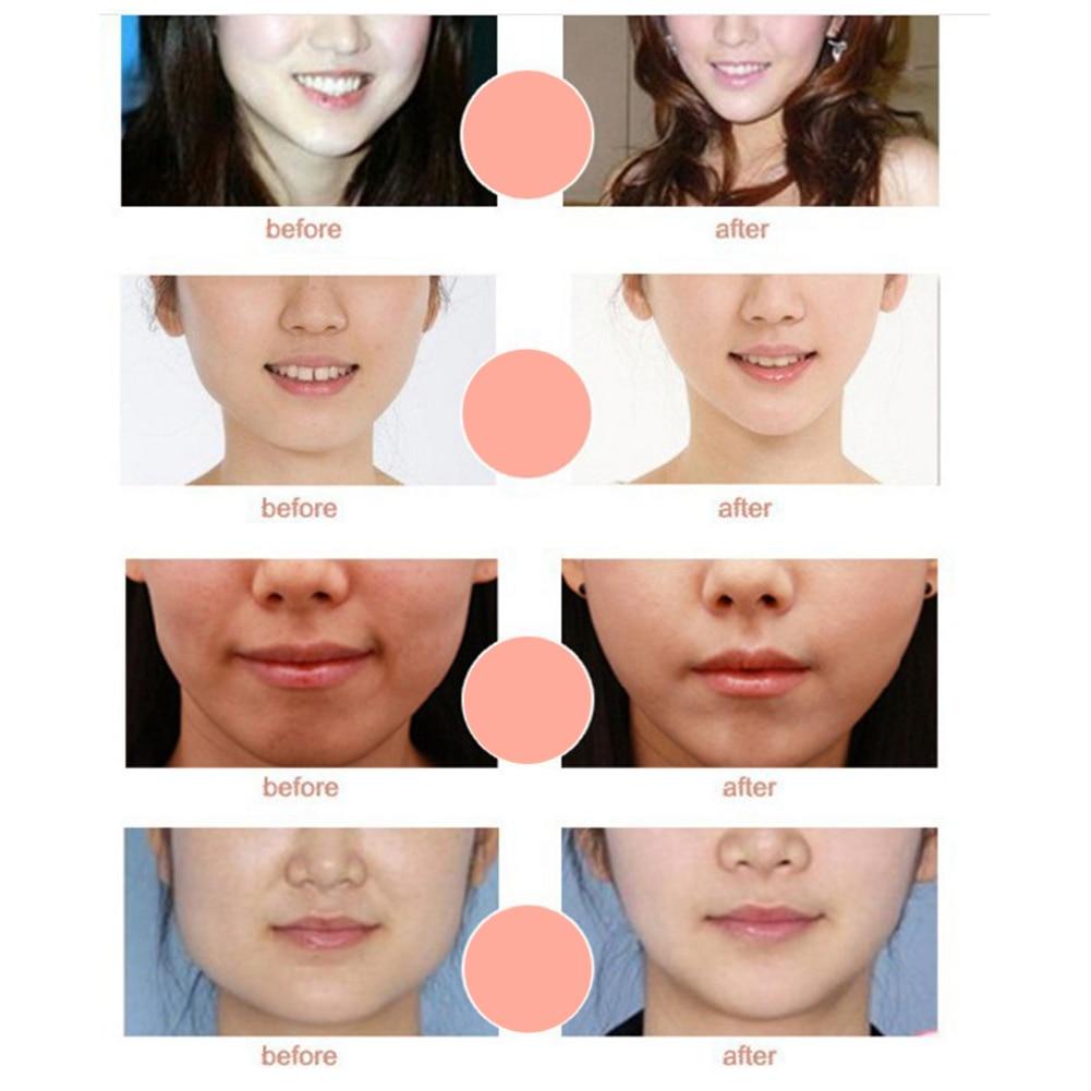 V-Shaped Slimming Mask (3 PCS)