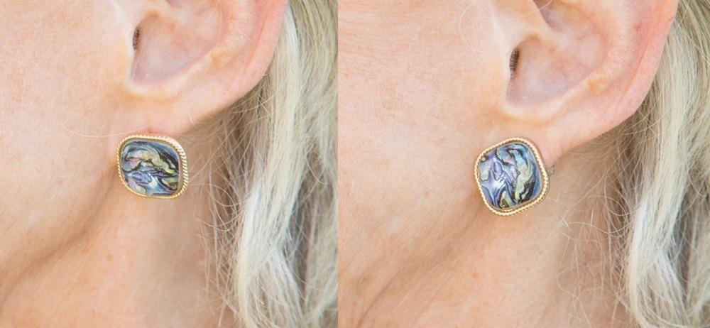 Earring Lift Back Clasp Support