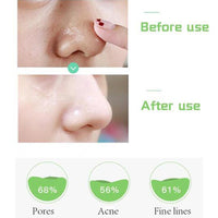 Thumbnail for Greenlouch Pore Corset Serum