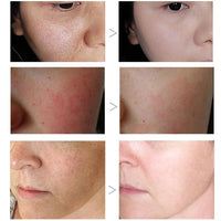 Thumbnail for Greenlouch Pore Corset Serum