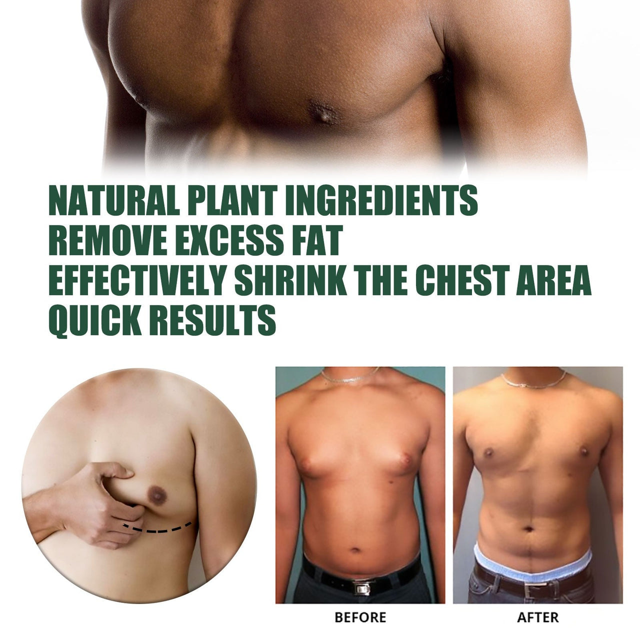 Solipac Gynecomastia Tightening Ginger Cream